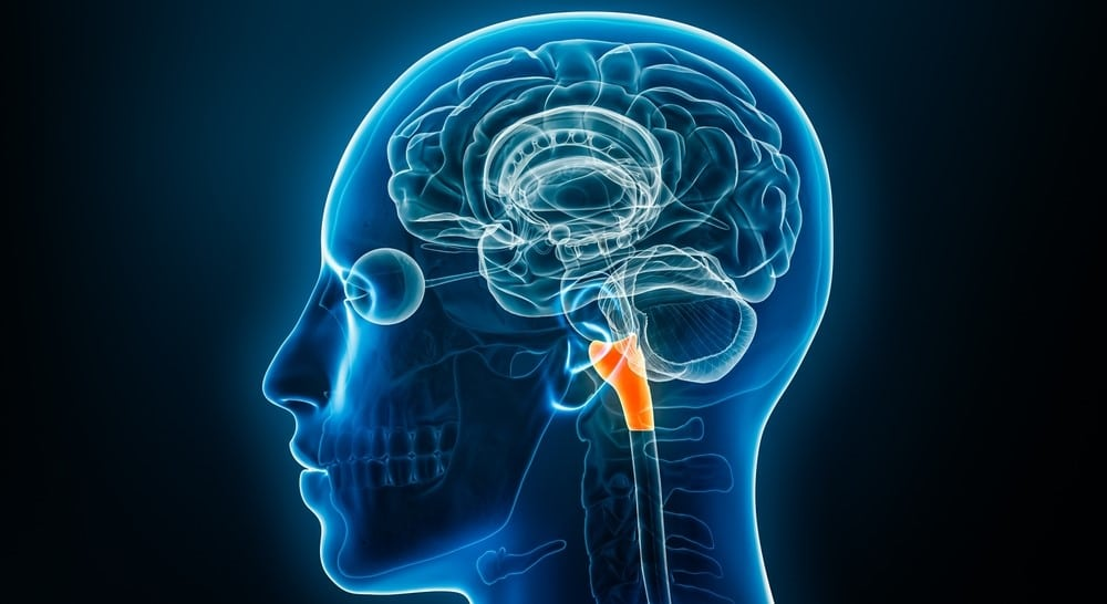 Chiari Malformasyonu