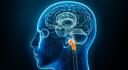 Chiari Malformasyonu