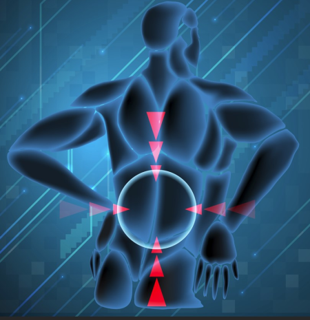 Spina Bifida