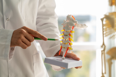 Spinal Arteriovenöz Malformasyonlar